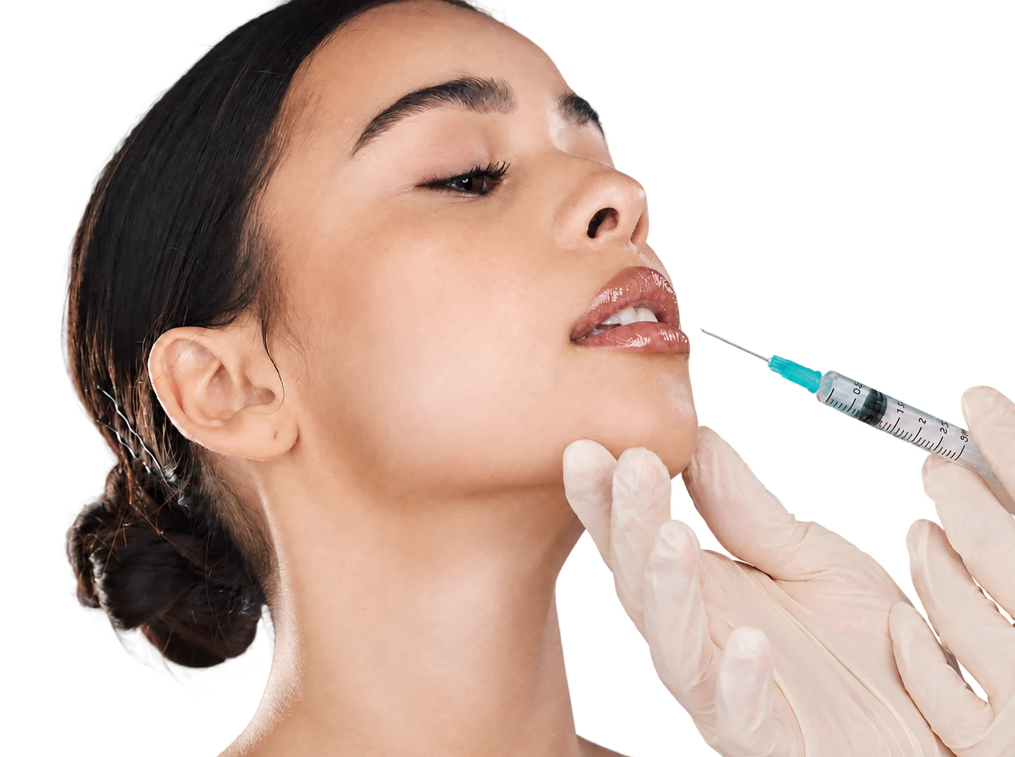 Woman with her head tilted back as a gloved provider injects filler into her lip